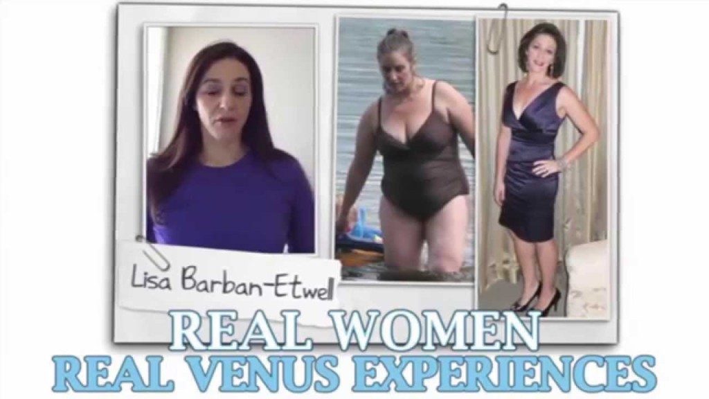 Venus Factor before and after