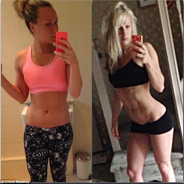 Chloe Madeley before and after