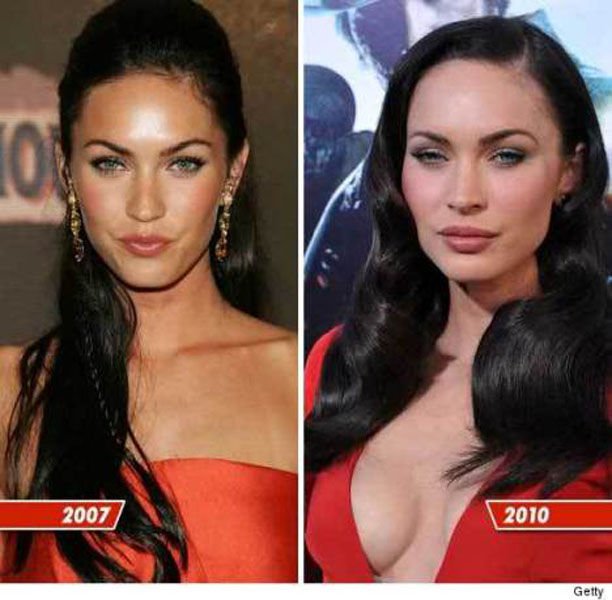 Celebrities with plastic surgery